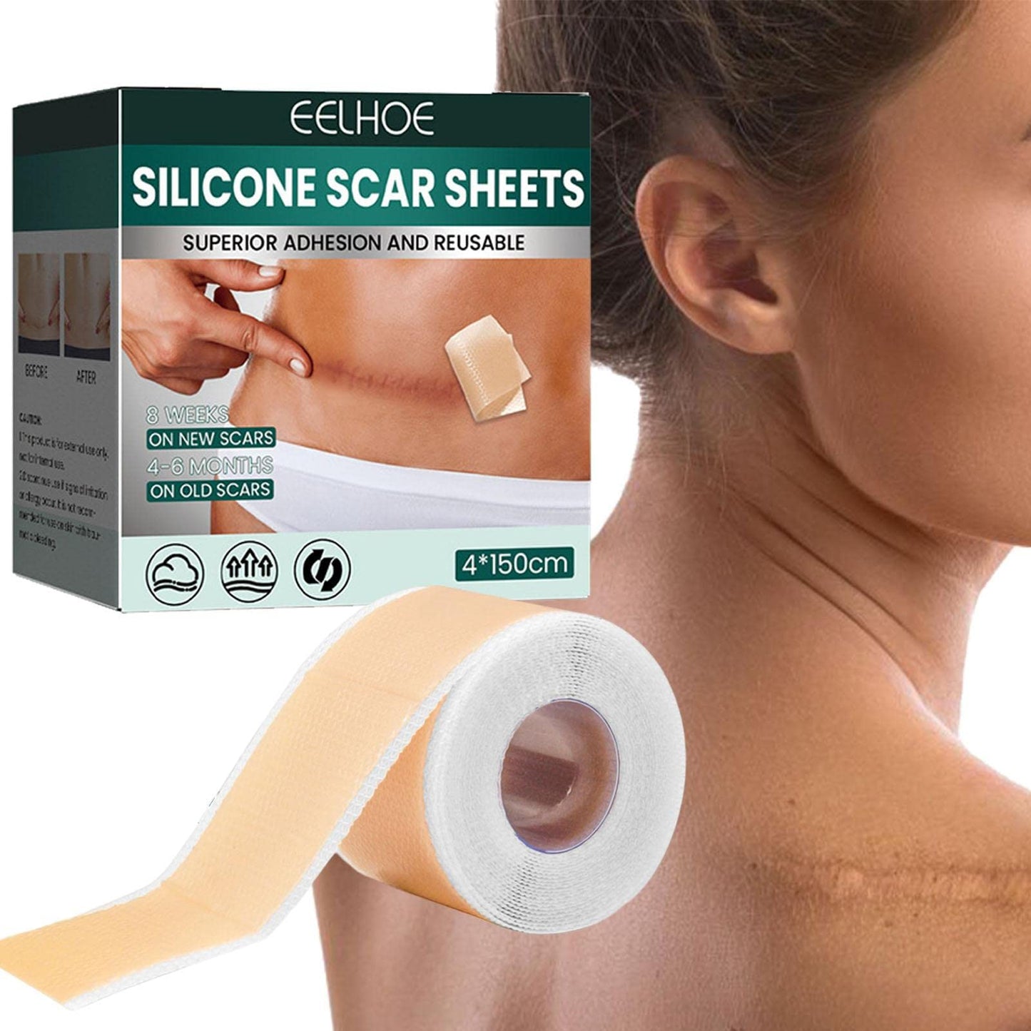 Silicone Scar Sheets™