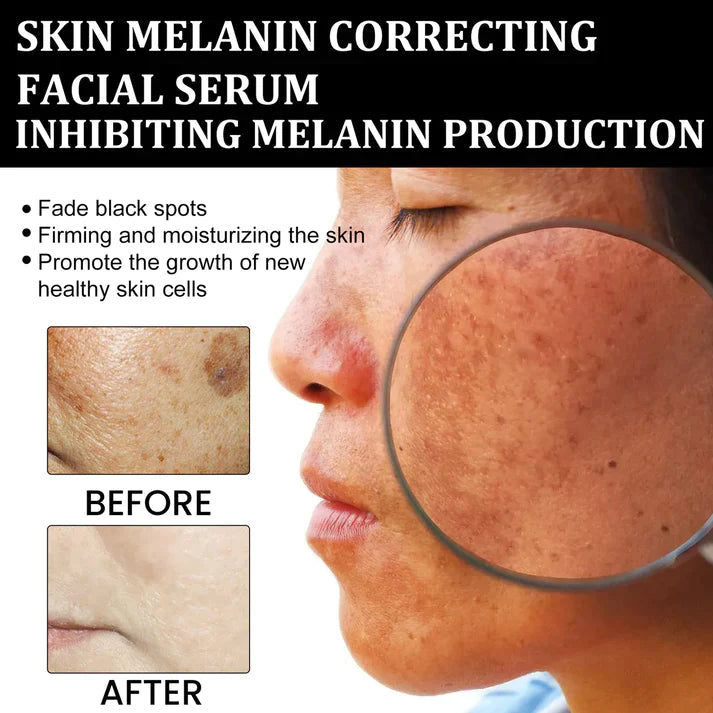 MelanClear Facial Serum