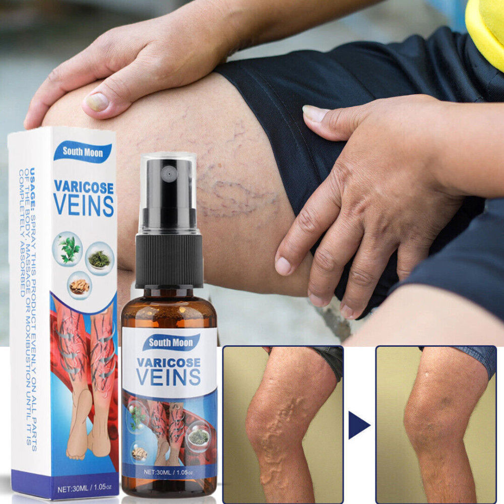 ORIGINAL™ Varicose Veins Remover Spray